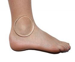 2 Ankle Gel Discs for Boot (Pad for Figure Skating, Ice Hockey, Roller or Ski) with Bag by CRS C ...